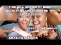 HOW TO GET RID OF BUMPS ON THE FACE FAST!! | Get rid of dark underarms fast| Visita Plus Review
