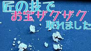 【耳かき】【匠の技】カサカサ質の耳垢【EARWAX】