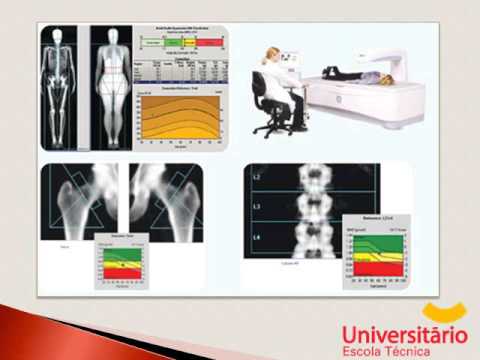 En que consiste una densitometria osea