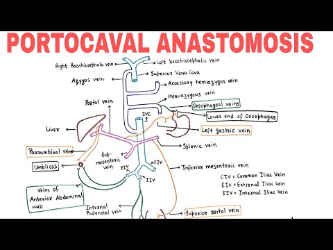 PORTOCAVAL ANASTOMOSIS |  PORTOSYSTEMIC COMMUNICATIONS