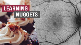 BluePeak Image Acquisition | SPECTRALIS