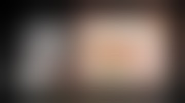 No.21  Uniportal VATS Right S6 Segmentectomy　単孔式胸腔鏡下右肺S6区域切除術【高画質HD】