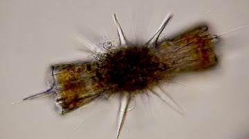 Diploconus – a radiolarian with endosymbionts