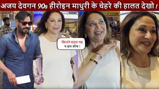 Ajay Devgan 90s हीरोइन Madhuri Dixit के चेहरे की हालत देखो ! चिपके गाल मोटा चेहरा हो गई ऐसी हालत