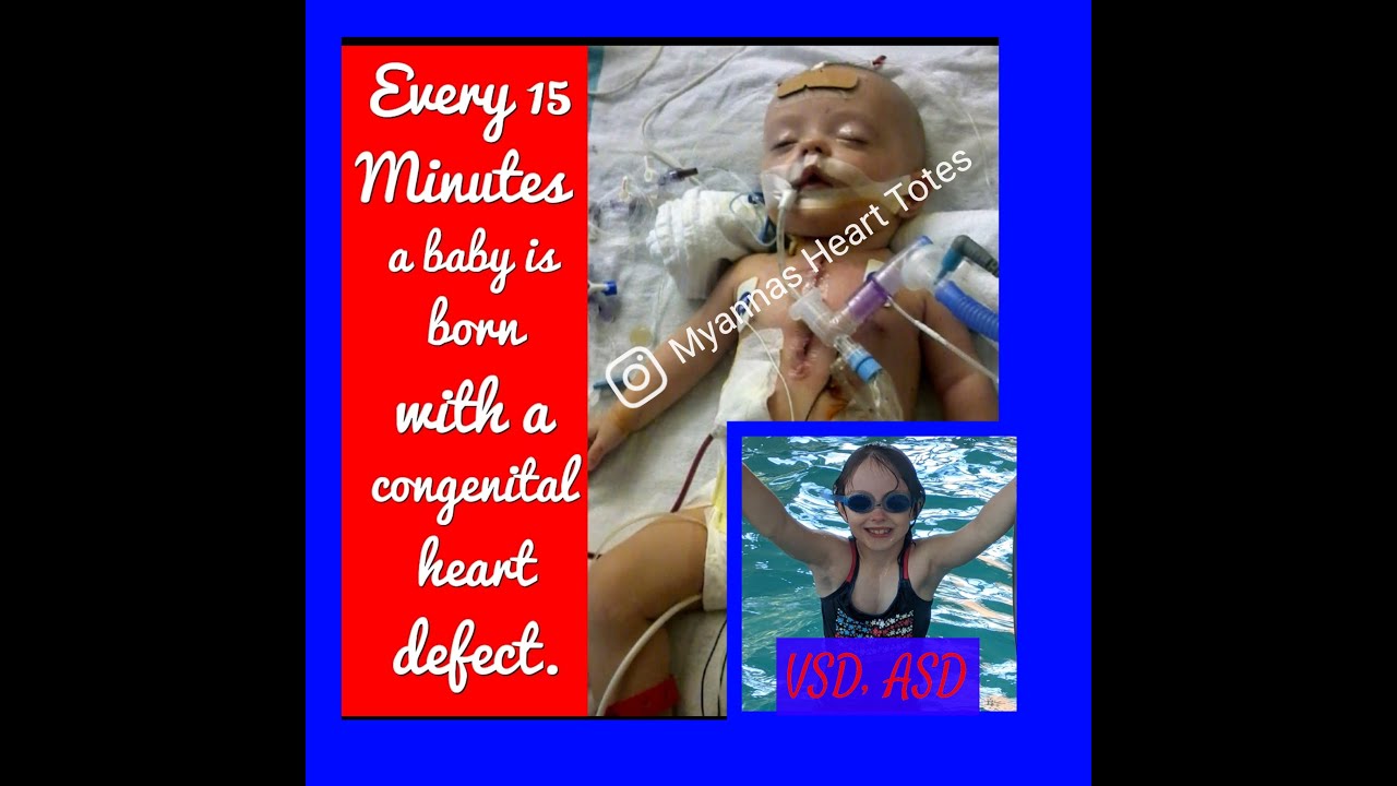 Congenital Heart Defects; CHD Heart Warriors 2021