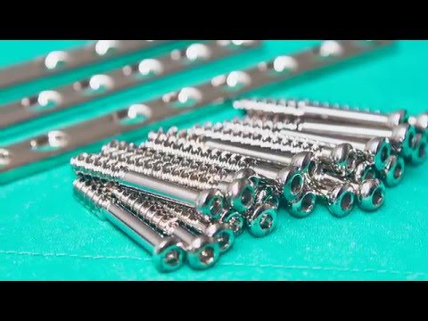 Norman Noble Orthopedic Machining - Titanium Implant Machining