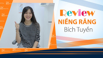 [Review niềng răng]: #148 Kết quả niềng răng của Bích Tuyền