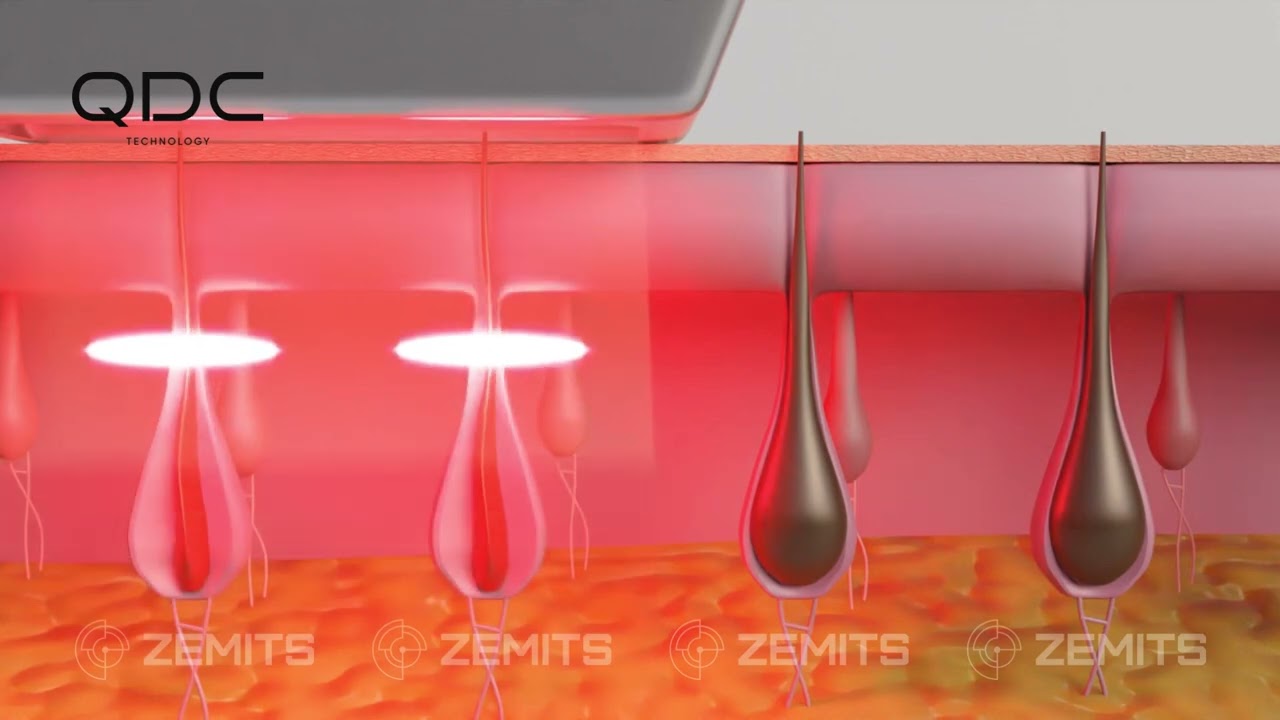 Купити діодний лазер для епіляції Zemits Quidion 808