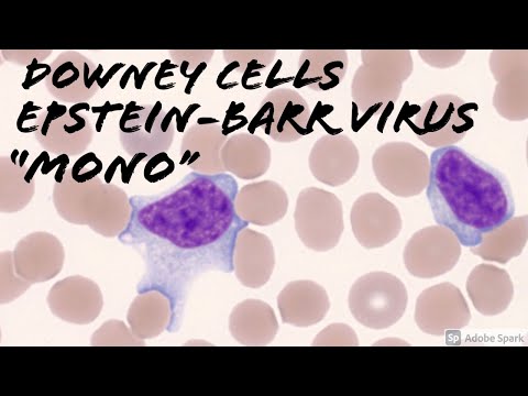 Downey cells (reactive