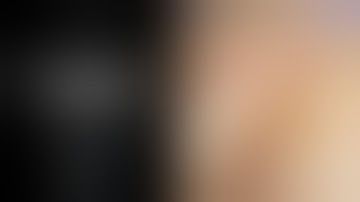 Head and neck: infratemporal fossa superficial