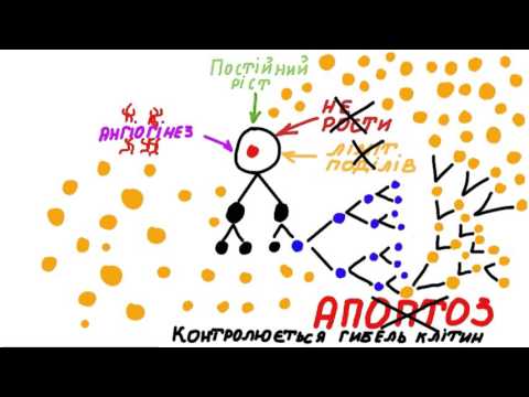 Що таке рак простати