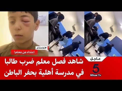 عاجل تعليم حفر الباطن يفصل معلم ضرب طالبا في مدرسة منار السبيل الأهلية