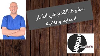 سقوط القدم في الكبار  اسبابه وعلاجه  - د احمد العطار