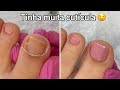 Transformação nas unhas dos pés | Cutícula e esmaltação