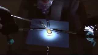 DaVinci Robotic Surgical System - Peeling a Grape