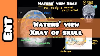 Waters’ view of Skull: #usmle #firstaid for #inicet #neetpg #nclex