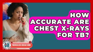 How Accurate Are Chest X-rays For TB? - Tuberculosis Disease Guide