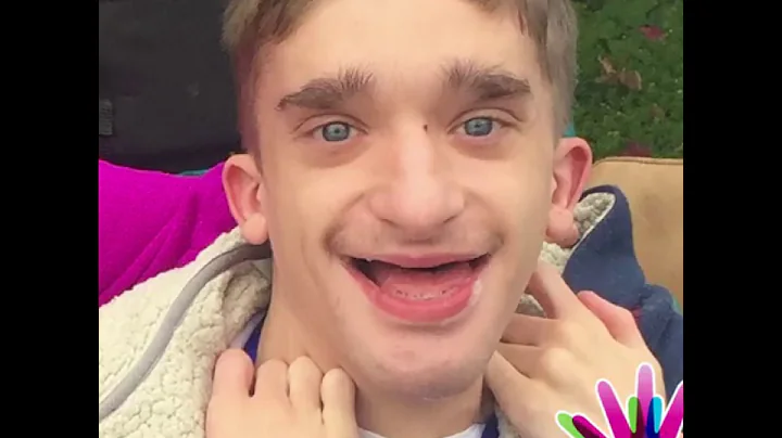 The Faces of Mowat-Wilson Syndrome - 2018