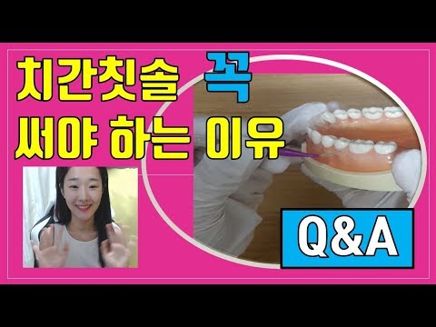 {누버 치과} 치간칫솔 피 ?? 아직도 고민하세요?/ 입냄새제거 하는법/ 풍치 치료말고 예방하자/ 치과위생사 TALK/ interdental brush/ 치아교정 양치법