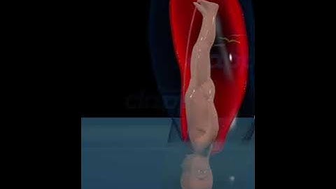 Thumbnail of Miracle of water birth #education #everyone