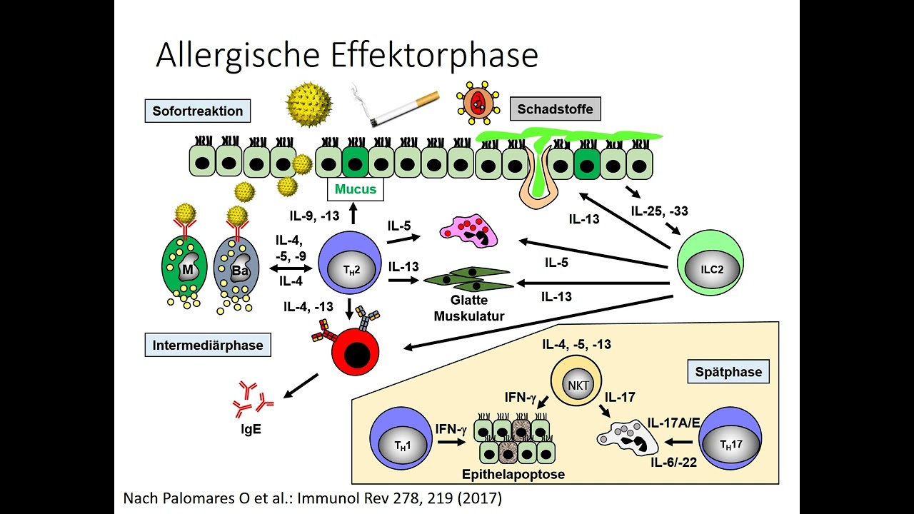 Teil 40: Dupilumab und PID