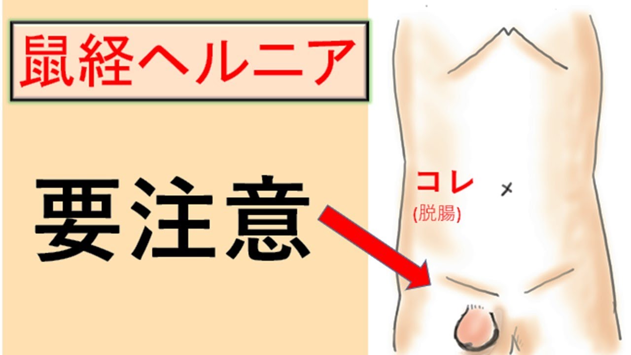 脱腸 症状 写真