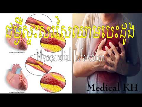 Myocardial Infarction_ជម្ងឺស្ទះសរសៃឈាមបេះដូង_នាទីសុខភាពខ្ញុំ#Dr. Liv Ching