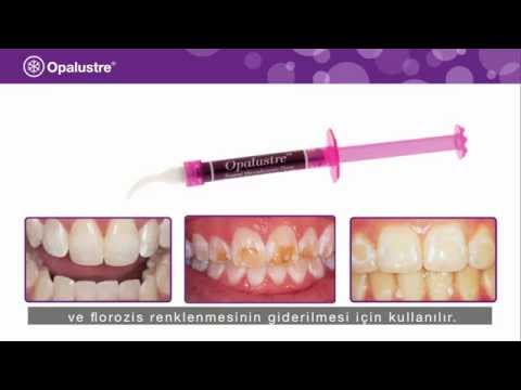 Отбеливание зубов opalustre Отбеливание зубов opalustre держатели для зубных щеток