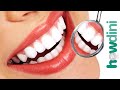 Teeth Whitening Tips: How to Remove Stains From Teeth