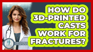 How Do 3D-printed Casts Work For Fractures? - Orthopedic Support Network