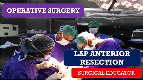 LAP ANTERIOR RESECTION/ STEP BY STEP  OPERATIVE SURGERY