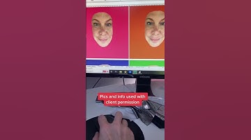 Colour analysis and redness or rosacea 💕🎨⭐️ #coloranalysis #colouranalysis