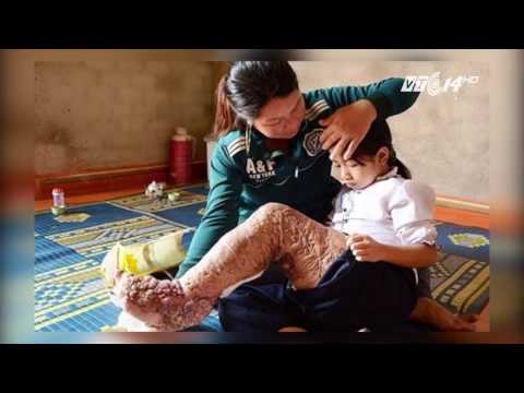 Video: Nhiều Bệnh Tật Và đau đớn Kéo Theo Thời Gian Sống Lâu Hơn Cho Vật Nuôi - Quản Lý Bệnh Và đau ở Vật Nuôi Lớn Tuổi