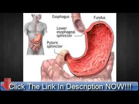 better than nexium acid reflux