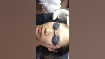 XÓA XĂM LÔNG MÀY ĐỔI DÁNG MỚI l THẨM MỸ RIO