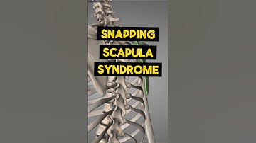 Snapping scapula syndrome causing shoulder pain? Try this exercise!