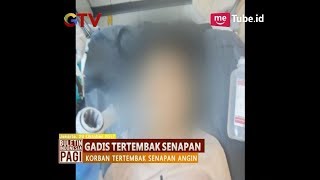 Niat Hati Berburu Burung, Seorang Pria Malah Menembak ABG Hingga Tembus ke Otak - BIP 30/10