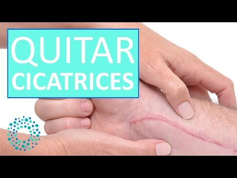 CURAR CICATRICES - Como eliminar las cicatrices