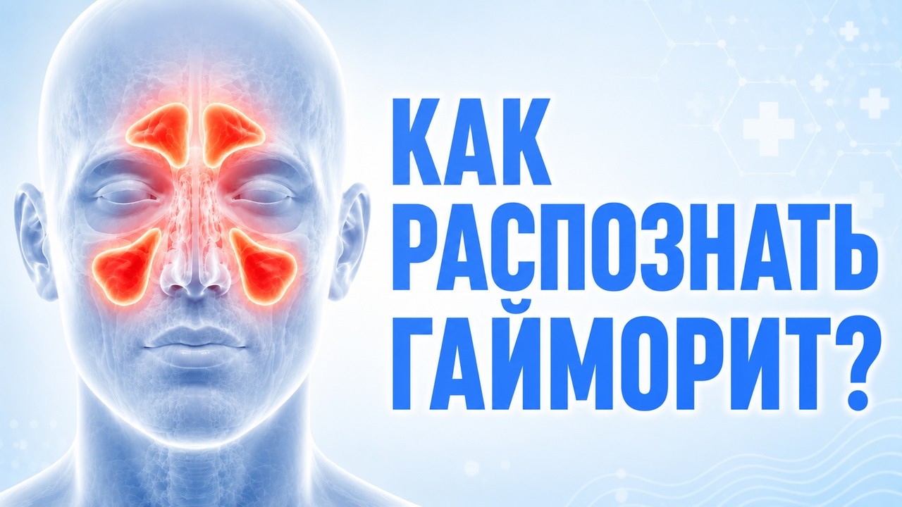 Заложенность носа и дыхание ртом: признаки искривления … — Transcript