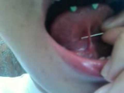 para que es el piercing debajo de la lengua para que es el piercing debajo de la lengua