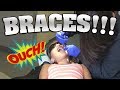 JILLIAN GETS BRACES!!! OMG, I'm So Nervous!