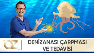 Denizanası çarpması belirtileri ve yapılması gerekenler neler?