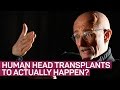 Human head transplant to happen in China