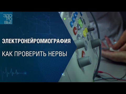 Электронейромиография. Как проверить нервы. На здоровье 16.07.2022
