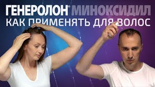 Как применять Генеролон для роста волос
