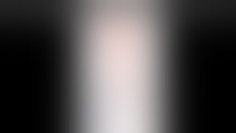 Femoral Perm catheter placement | Tunneled dialysis catheter via. femoral route in hyderabad