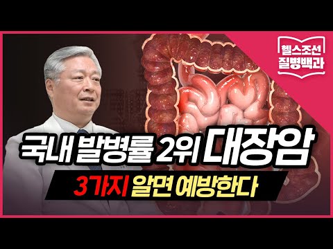 [대장암] 국내 발병률 2위 &rsquo;대장암&rsquo;...3가지 알면 예방한다