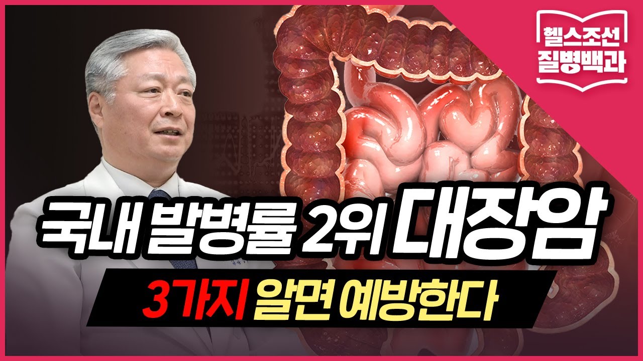 [대장암] 국내 발병률 2위 '대장암'...3가지 알면 예방한다