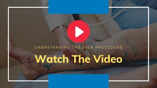 EVLT Minimally Invasive Surgery for Varicose Veins