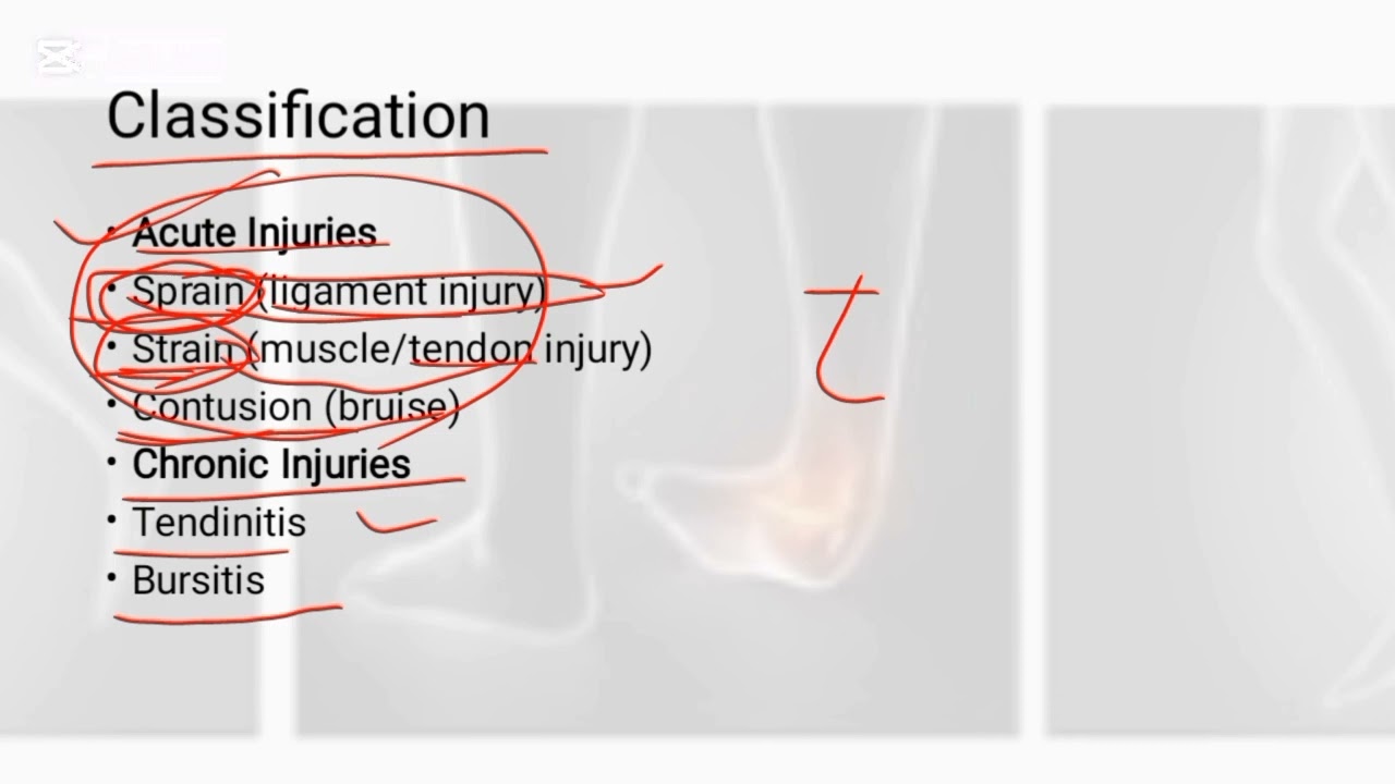 Soft Tissue Injury Explained in Easy Way | Nursing Students Lecture
